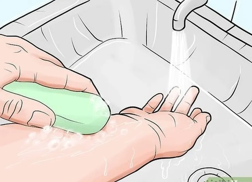 шаг 1после укуса вымойте пораженный участок водой с мылом.