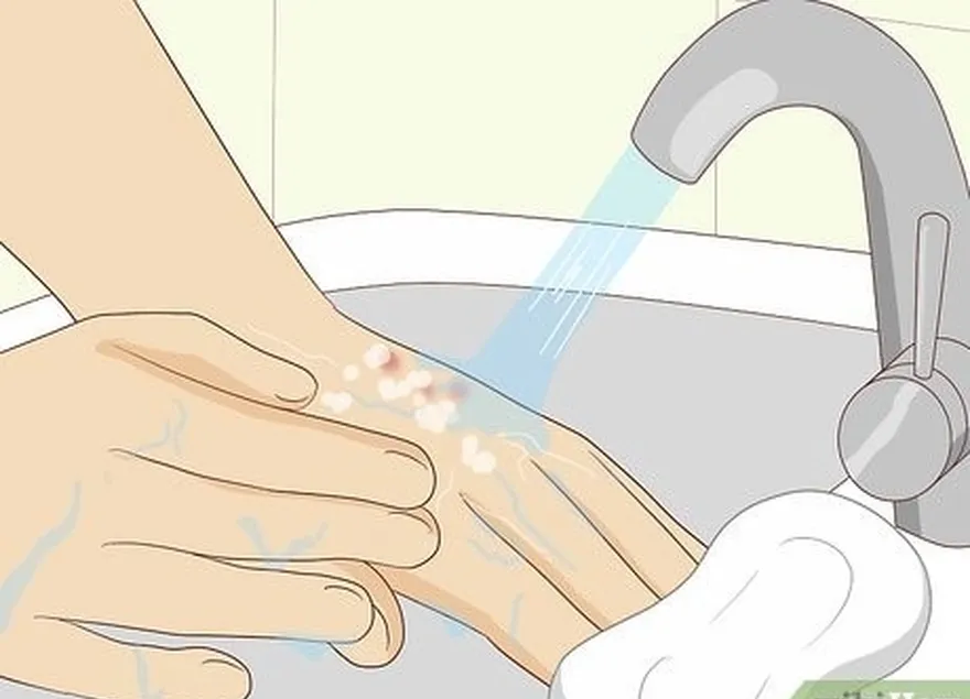 шаг 1 промойте укусы водой с мылом.
