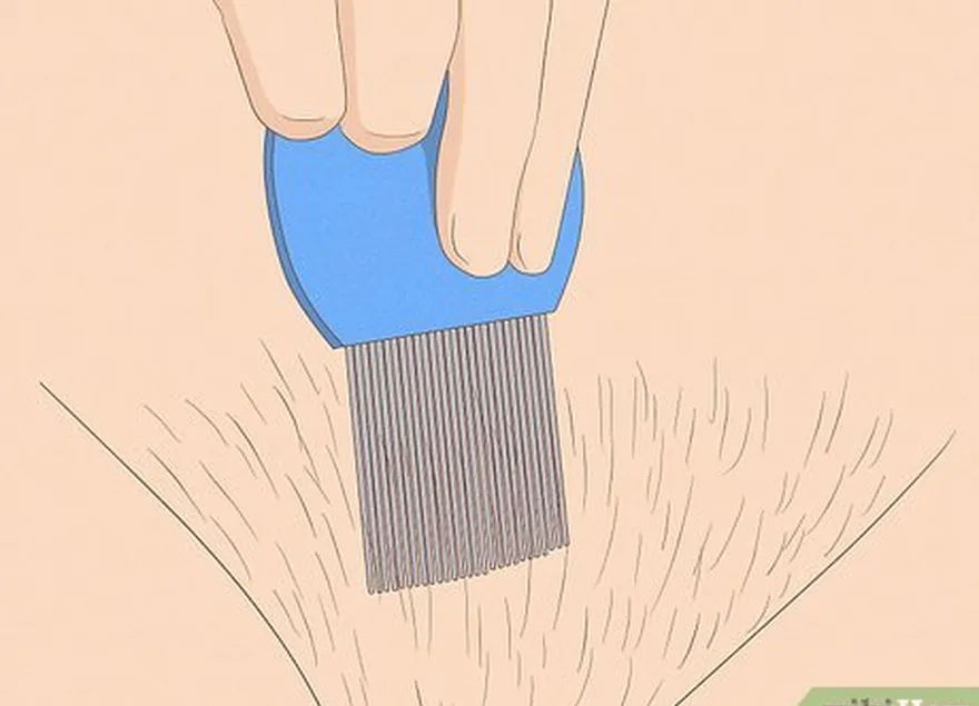 шаг 6 используйте расческу с мелкими зубьями, чтобы удалить все гниды.