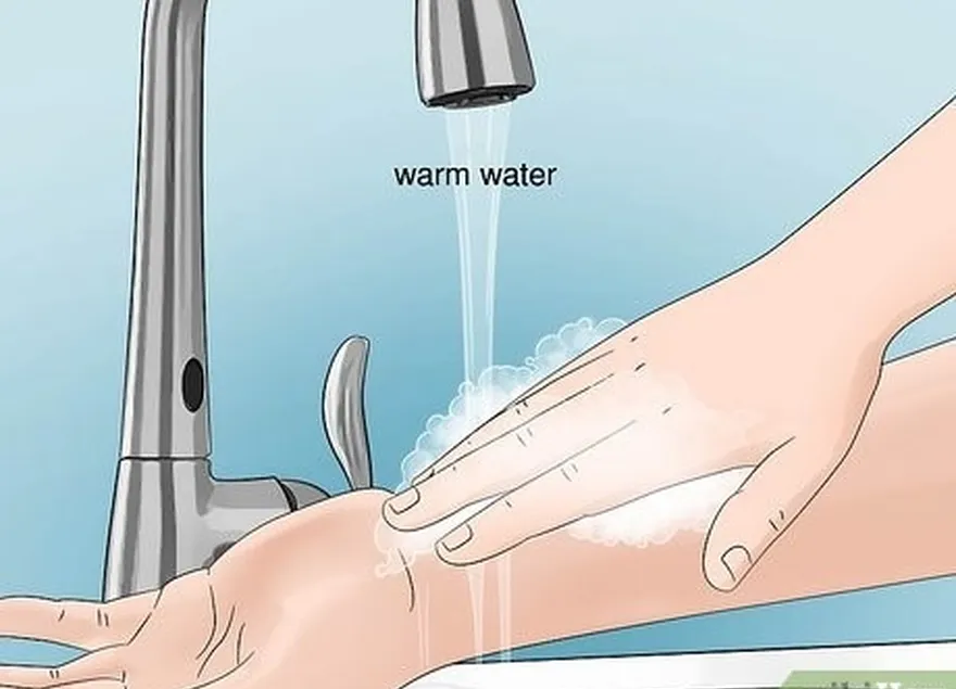 шаг 1 промойте место укуса блохи теплой мыльной водой.