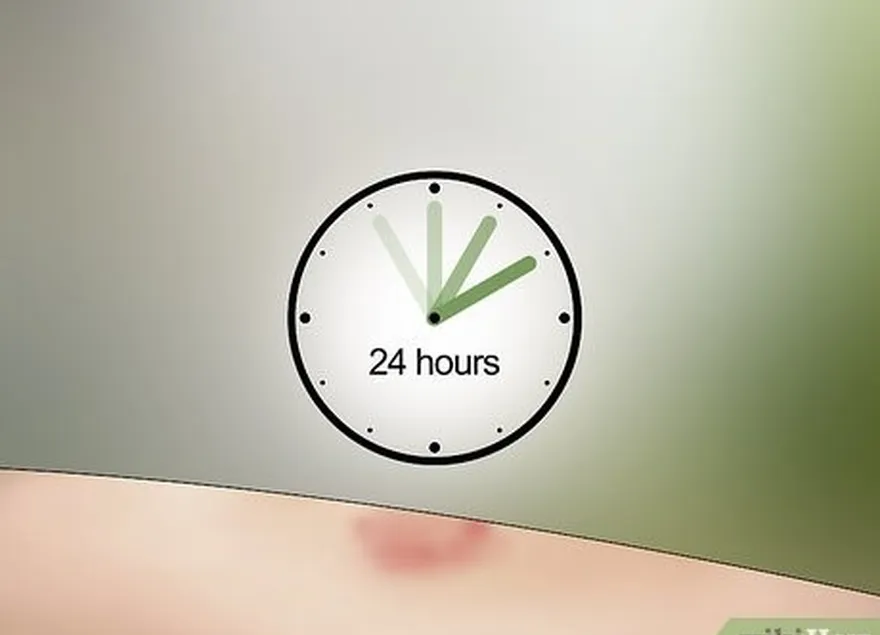 шаг 7 наблюдайте за укусом в течение следующих 24 часов, чтобы убедиться, что симптомы не проходят't worsen.
